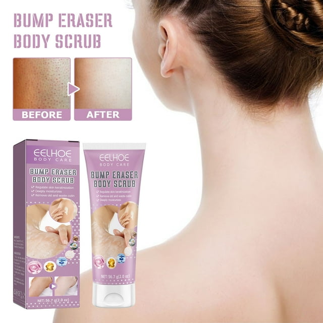 Exfoliante corporal, adecuado para queratosis capilar Exfoliante corporal áspero suave y cómodo