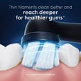 thumbnail image 4 of Oral-B iO Gentle Care Replacement Heads, Electric Toothbrush Brush Heads, Black, 4 of 16