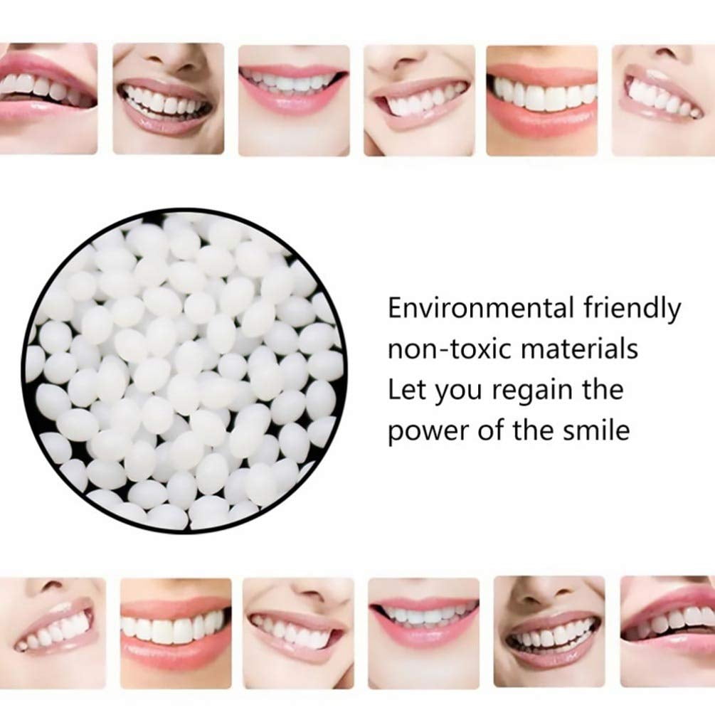 1 bag 100g Tooth Thermal Adhesive Fitting Beads Temporary Teeth Repair Veneer Replacement Teeth