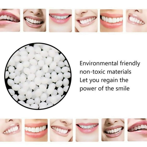 1 bag 100g Tooth Thermal Adhesive Fitting Beads Temporary Teeth