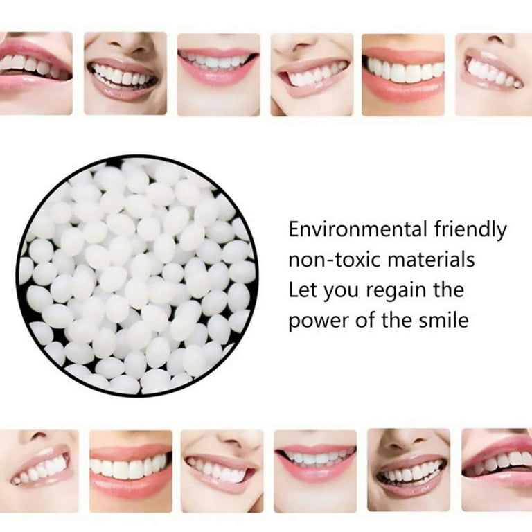 Thermal Beads Repair Granules Teeth Veneers Moldable for Big Gaps