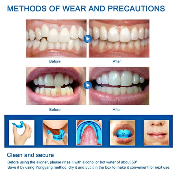Dental Orthodontic Teeth Corrector Transparent Braces Tooth Retainer; Transparent  Braces Tooth Retainer Teeth Straighten Correction Tools 