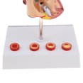 thumbnail image 4 of 1: 1 Modelo Estrutura de Sistema Corazones Patológico Trombo de 4 Juguete Educativo Escolar Sunnimix Estatua del corazón humano, 4 of 8