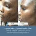 thumbnail image 6 of Dr. Thrower’s Oily Skin Facial Cleanser with Salicylic Acid (0.5%), Eucalyptus, and Peppermint, 2oz, 6 of 10