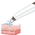 thumbnail image 3 of Electric Pore Cleaner USB Rechargeable Portable Blackhead Remover Acne Remover, 3 of 10