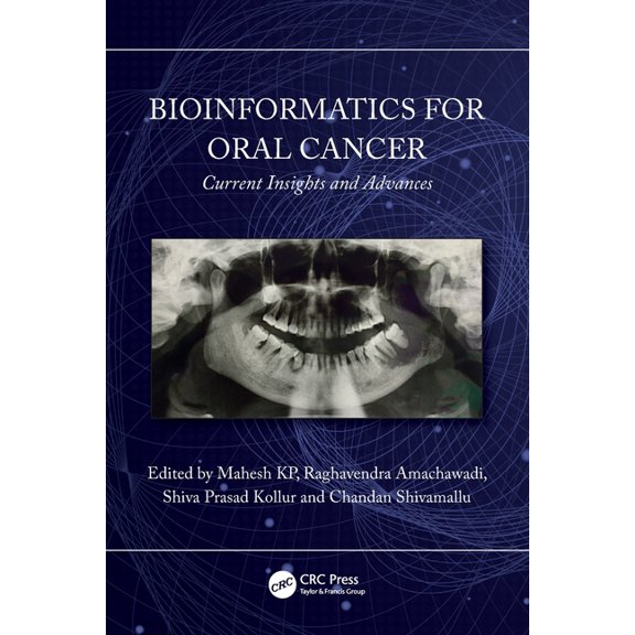 Bioinformatics for Oral Cancer: Current Insights and Advances, (Paperback)