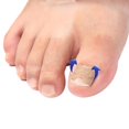 thumbnail image 3 of 100pcs Toenail Correction Patch Glue Free Pedicure Tools Corrector Toe Nail Ingrown Patch, 3 of 3