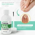 OrientLeaf Nail Fungus Treatment, Toenail Fungus Treatment, Fungus Stop
