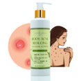 thumbnail image 1 of Body Acne Reducing Natural Lotion with Neem & Manuka for Acne Relief & Soothing Hydration, 8 oz by LatherGreen, 1 of 6