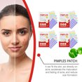 thumbnail image 3 of 240pcs Acné de ácido salicílico parches Star Pimple parche acné colorado invisible eliminación del acné cuidado de la piel pegatinas mancha de la cara corrector, 3 of 5