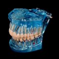 thumbnail image 5 of Dental Study Teeth Model Transparent Adult Pathological Disease Tooth Dentistry, 5 of 5