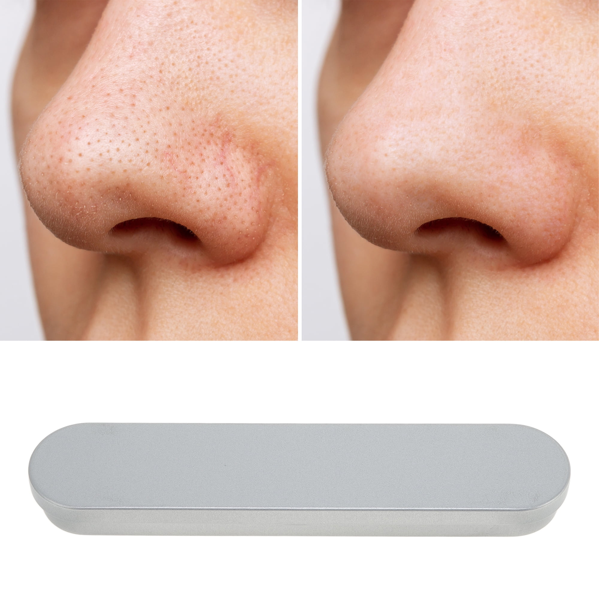 Unique Bargains 1pc Durable Squeeze Pimple Extractor Tool for Clear Skin Silver Tone