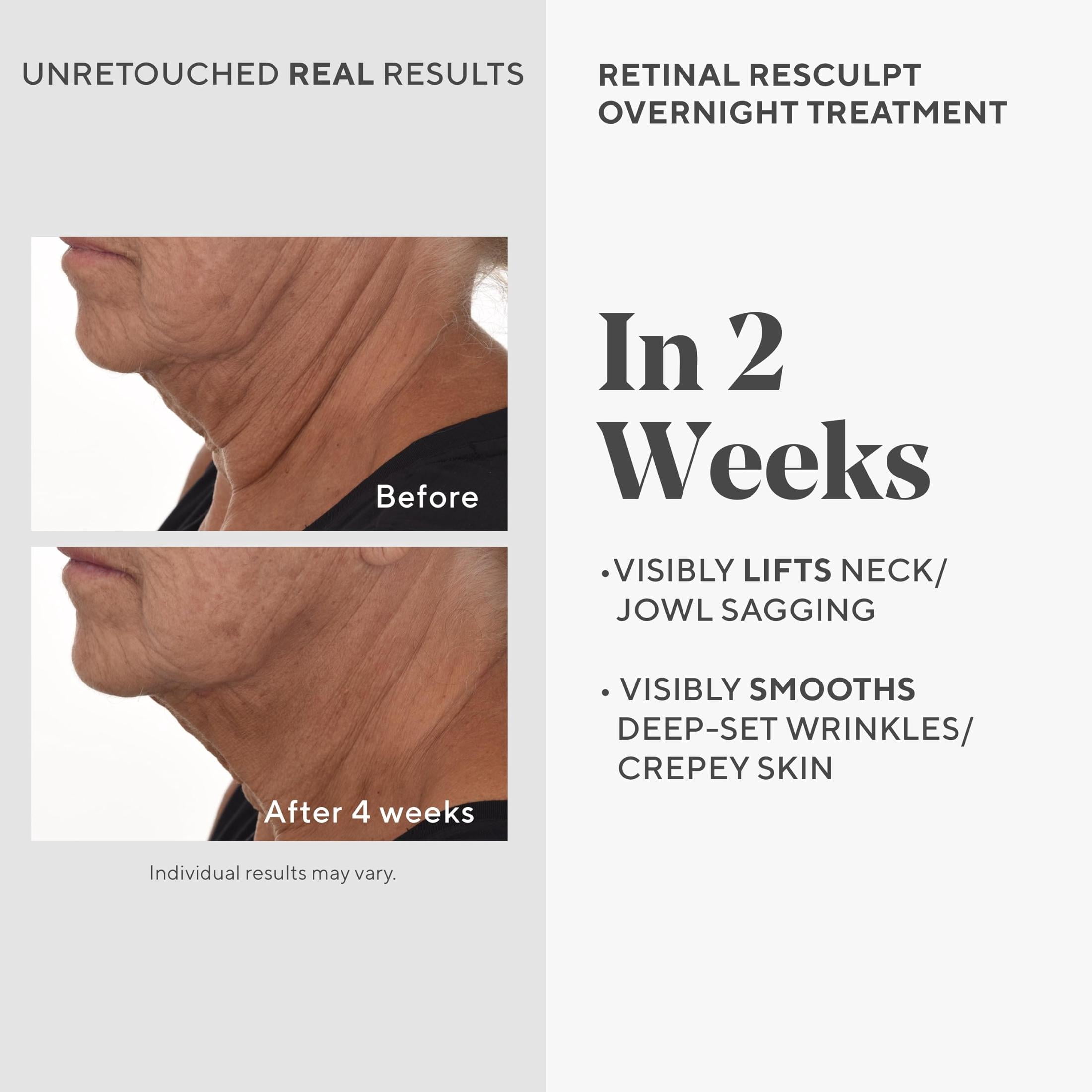 Murad Retinol ReSculpt Overnight Treatment, Smoothing Serum, 1 fl oz