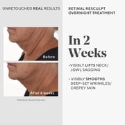 Murad Retinol ReSculpt Overnight Treatment, Smoothing Serum, 1 fl oz