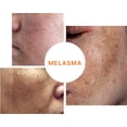 thumbnail image 4 of TRANACIX LSI CREMA C/30 G, 4 of 5