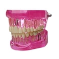 thumbnail image 3 of lionlar Dental Demonstration Teeth Model Observation Practical Removable Study Teach pink, 3 of 9