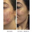 thumbnail image 4 of Herbivore Blue Tansy Resurfacing Clarity Mask 2.02 fl oz, 4 of 5