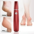 thumbnail image 2 of Red Rechargeable Electric Callus Remover Foot File With Multiple Speeds Portable Pedicure Tool For Home Use Dead Skin Exfoliator Device, 2 of 7