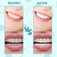 thumbnail image 3 of BPPEG 100Pcs Interdental Brushes Between Teeth for Braces,Flossers Brush Cleaner,Orthodontic Flossers for Braces Cleaning Kit,Dental Teeth Cleaning Tools(10 Colors,Multiple Sizes, 3 of 7