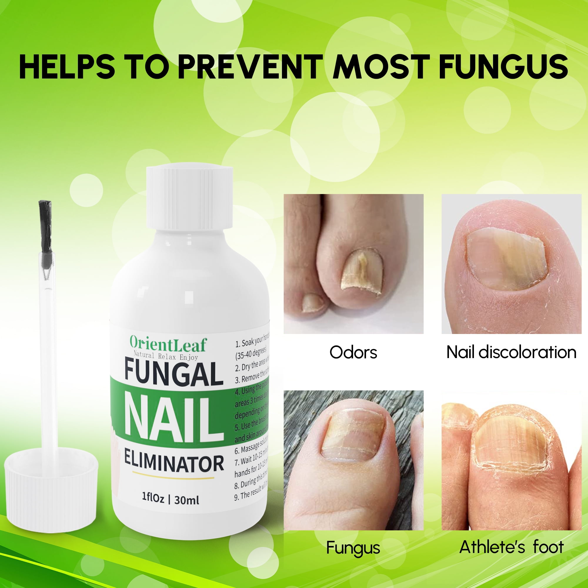Buy Earthen Echo Nail Fungus Oil, Anti-Fungal, Natural Effective Nail  Fungus Relief Oil, Herbal Essential Oil, Fast-Acting Infections & Nail  Fungus Oil - 50ml Online at Best Prices in India - JioMart.