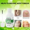 OrientLeaf Nail Fungus Treatment, Toenail Fungus Treatment, Fungus Stop