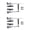 A, variant on Mountain Bike V Brakes Set, Aluminum Alloy Mountain Bike Brakes Bike V Brakes Cycling V Brakes Front Rear Brakes Parts