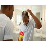 Virgin Hair Fertilizer With Biotin For Rapid Hair and Edge Regrowth, Hair And Scalp Energizer