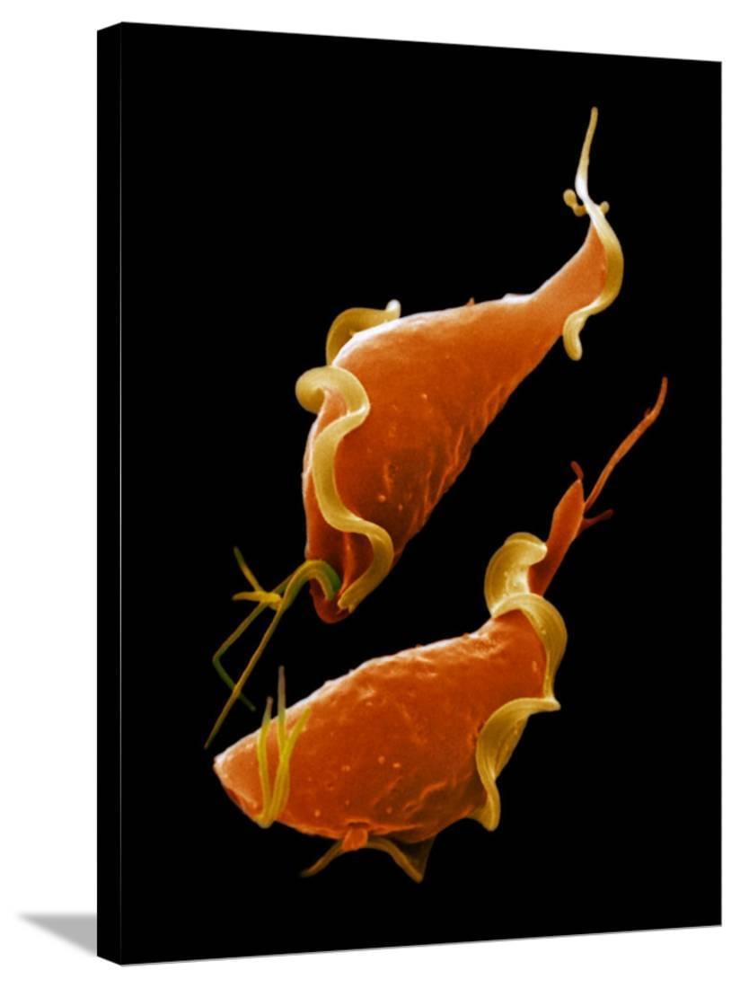 The Parasitic Protozoa Trichomonas Vaginalis Is The Cause Hot Sex Picture