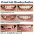 thumbnail image 4 of 4 Pcs Snap On Smile Teeth Veneers Whitening Cosmetic Denture, Tooth Cover Set, 4 of 4