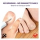 thumbnail image 3 of Parche corrector de uñas de los pies, pegatinas elásticas de corrección de uñas encarnadas, herramientas de pedicura, 3 of 10