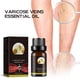 thumbnail image 5 of Price Drop Coconut oil Essential oils Venoheal Varicose Vein Ease Liquid Oil, Varicose Veins Liquid Oil, Varicose And Spider Veins Ease For Legs, Improve Blood Circulatio 10ml(buy 2 get 10% off), 5 of 5