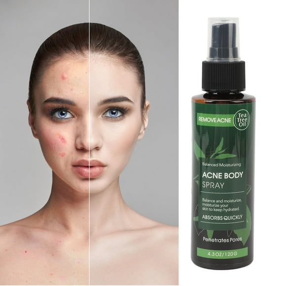 Spray de espinilla, spray de espinilla universal de cuerpo amigable para la piel para uso diario