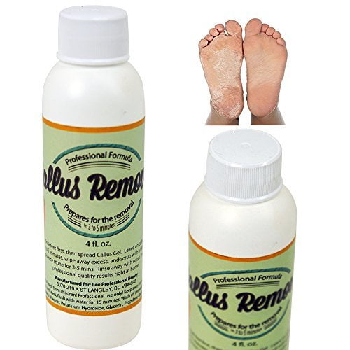 Best Callus Remover. Callus Eliminator, Liquid & Gel For Corn And