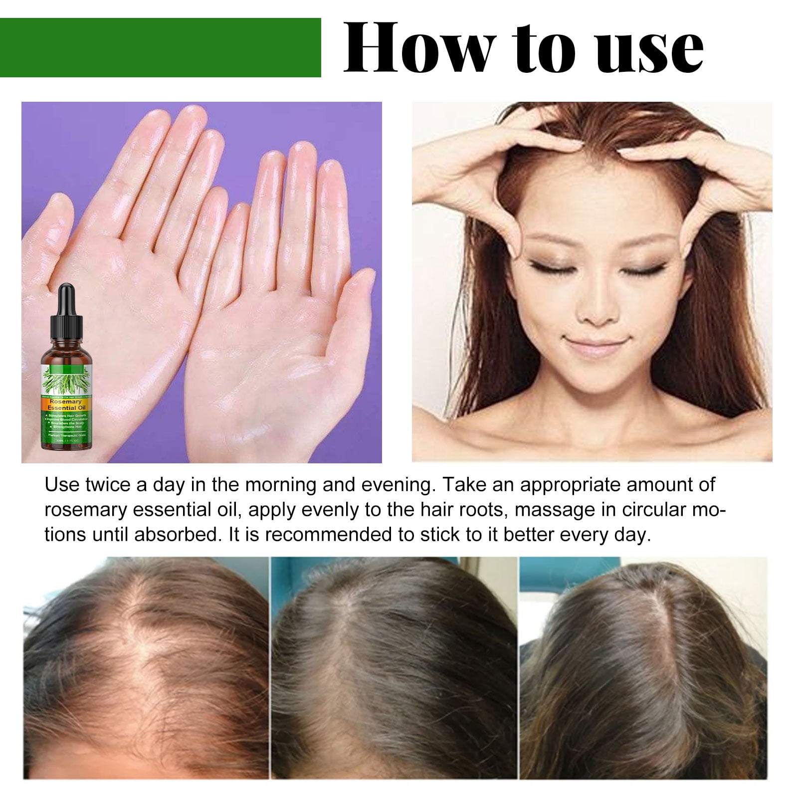 Alvantor Nourishing Hair Oil with Rosemary and Castor for Dry Scalp, 1.01 fl. oz