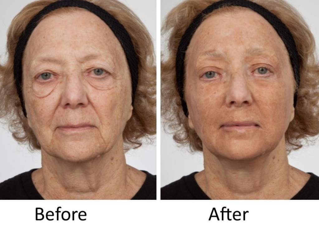 Dr Sevinor Genuine-Original Amazing Wrinkle Solution Wrinkle Smoothing Tinted Serum 1fl oz As Seen on TV!