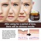thumbnail image 2 of Retinol Cream Anti-aging Wrinkle Brightening Skin Hydrating Facial Skin Cream Fi, 2 of 3