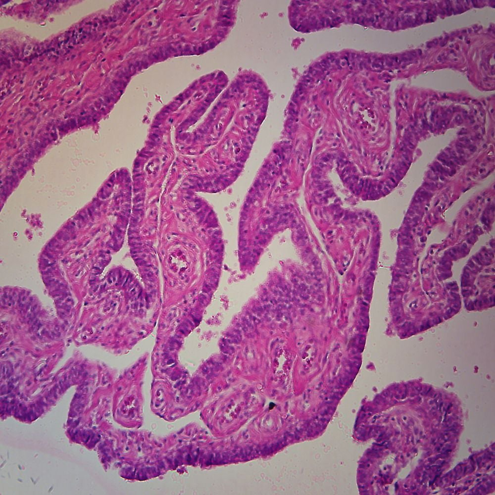 Human Fallopian Tube c s 7 m H E Microscope Slide Human Fallopian Tube c s 7 m H E Microscope Slide