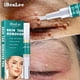 thumbnail image 1 of Pluma de aceite esencial para eliminación de verrugas de 3ml, removedor de marcas en la piel, producto de belleza para el cuidado de la piel Ygjytge Cuidado Belleza, 1 of 7
