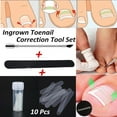 thumbnail image 2 of Ingrown Toenail- Straightening Clip Curved Toenails Thick Correction Tool Foot.Transparent Straightening Elastic Patch, 2 of 10
