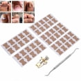 thumbnail image 3 of Ensemble d'Outils d'Ongle Incarné, Outils de Correction d'Ongle Incarné Correcteur d'Ongle Incarné Auto-Adhésif Outil de Raboteuse d'Ongle Incarné Lime Professionnel, 3 of 8