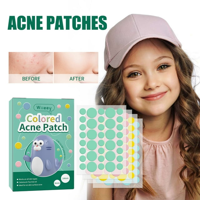 Parches para Granos (144 Unidades) | Parches Cicatrizantes con Forma de Estrella | Parches para Granos | Ingredientes Naturales | Seguro para Piel Sensible | 144 Adhesivos para La Piel