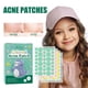 thumbnail image 1 of Parches para Granos (144 Unidades) | Parches Cicatrizantes con Forma de Estrella | Parches para Granos | Ingredientes Naturales | Seguro para Piel Sensible | 144 Adhesivos para La Piel, 1 of 7