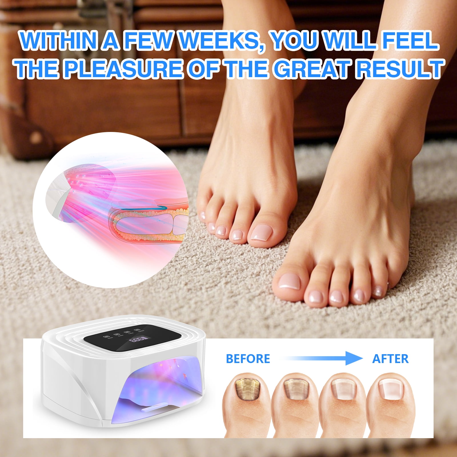 iKeener Rechargeable Nail Lamp Is Designed For Nail Fungus, With More Space