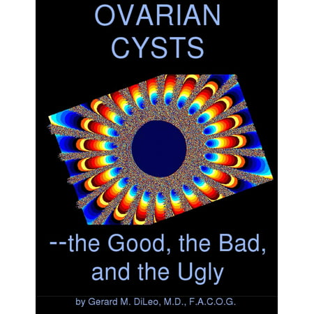 Ovarian Cysts: the Good, the Bad, and the Ugly - (Best Way To Treat Ovarian Cysts)
