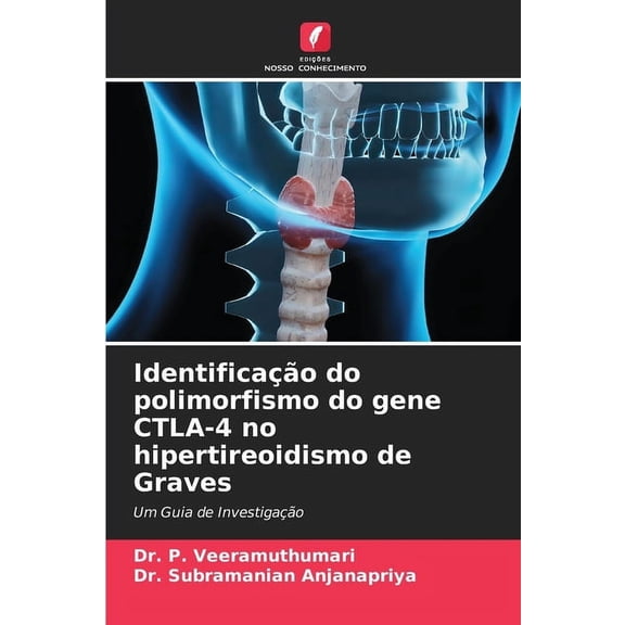 Identificação do polimorfismo do gene CTLA-4 no hipertireoidismo de Graves, (Paperback)