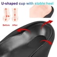 thumbnail image 4 of Arch Support Sleeves Orthotic Inserts for Flat Feet & Overpronation X/O Legs, 2Pcs, 4 of 5