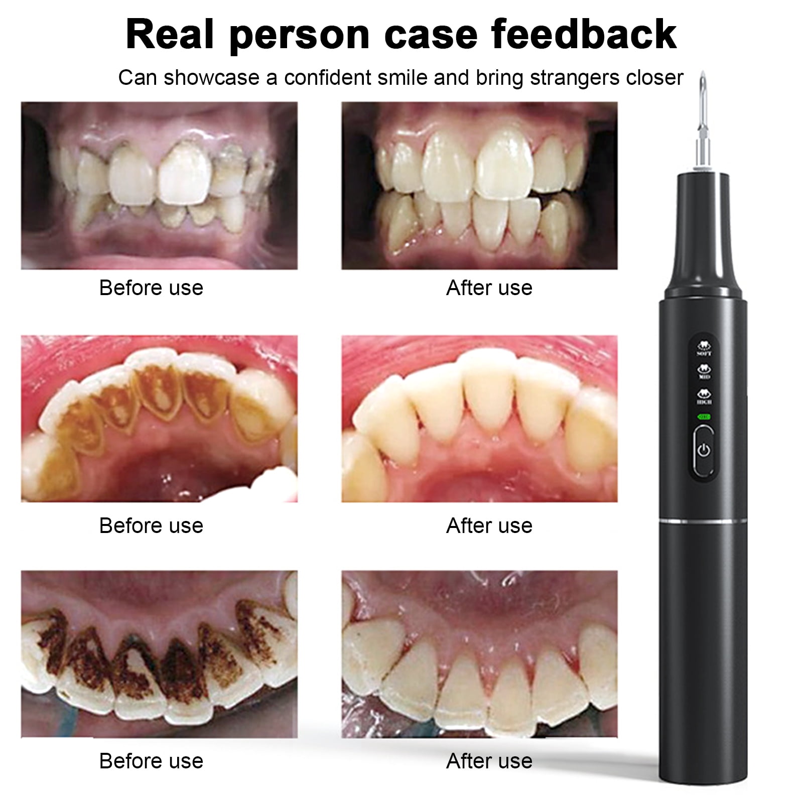 Oral irrigator,Cleaner Portable Oral Oral Use Portable Use Cleaner Led Use Portable Usecleaner Portable Led Care Tool Set Cleaner Scaler Oral Cleaner - Scaler Portable Scaler Set Cleaner