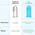thumbnail image 3 of SM Soft Silicone Pet Finger Toothbrush Tooth Cleaner Dog Cat Tooth Cleaning Brush, 3 of 8