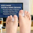 thumbnail image 3 of Gel Toe Corrector, 10 Pack Toe Separators with 2 Loops, Large Toe Spacer for Bunion Pain and Overlapping Toes, 3 of 5