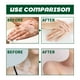 thumbnail image 3 of Crema para aliviar el vitíligo crema hidratante para el vitíligo de la piel con recuperación de melanina para uso diario ANGGREK Otros, 3 of 8